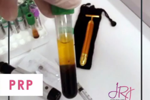 Plasma Rico en Plaquetas