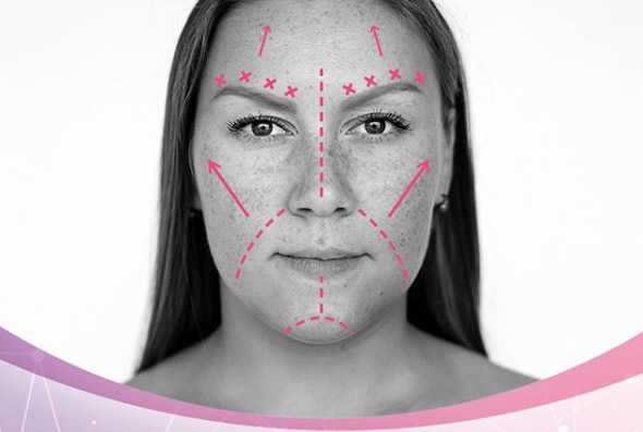 Ritidectomía (lifting facial)