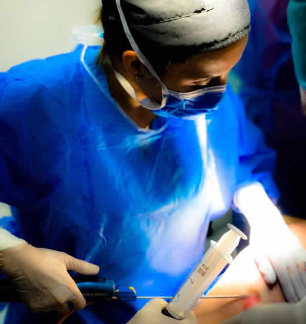 Lipoinyección de Glúteos